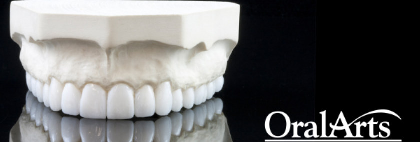 diagnostic_wax_up_feat_OACR