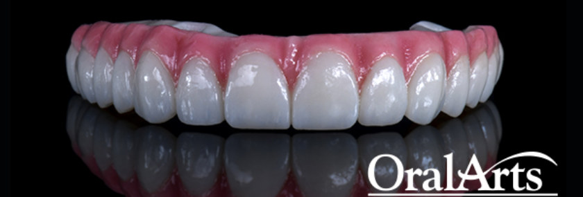 feat_zirconia_bridge