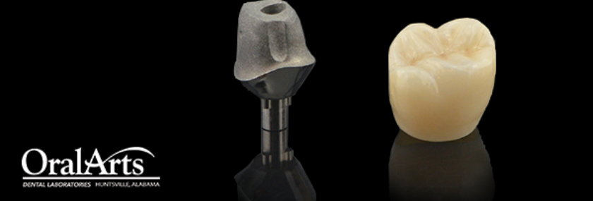 Restorations over Implants Feat Image