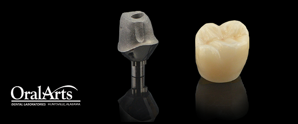 Restorations over Implants Feat Image